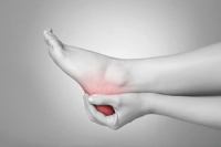 An Inflamed or Torn Plantar Fascia