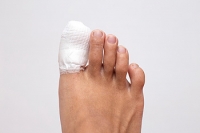 What to Expect When You Break Your Toe