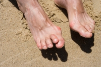 Does Hammertoe Have to be Treated?